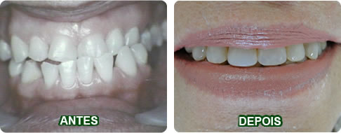 Pacientes-de-Ortodontia-2