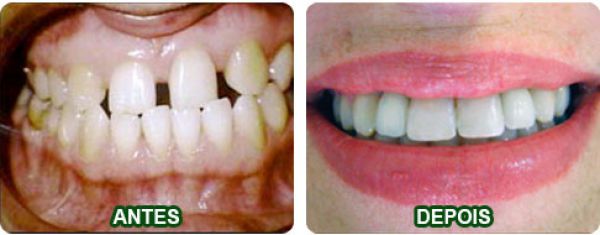 Pacientes-de-Ortodontia